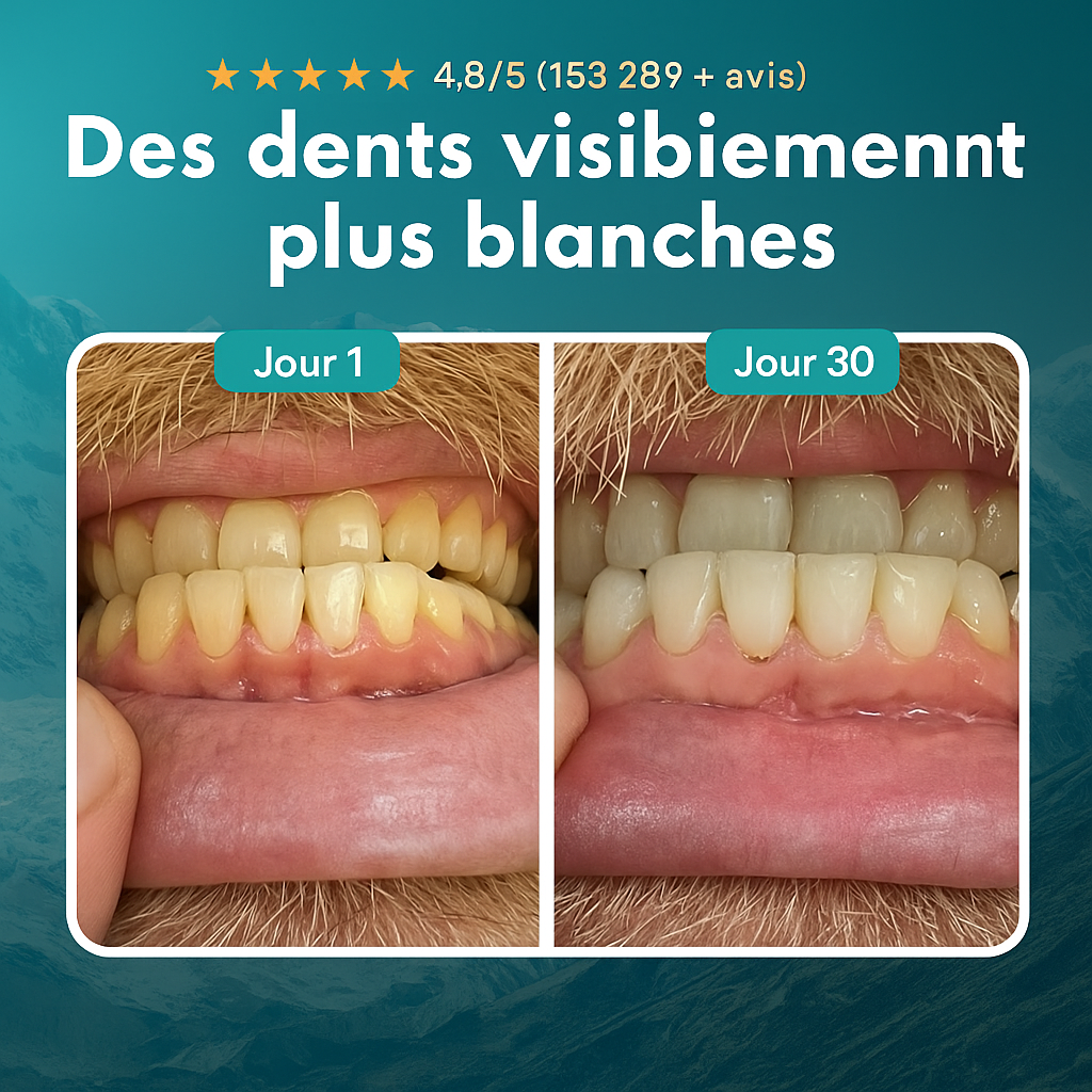 Nutrive | Chewing-Gum Reminéralisant