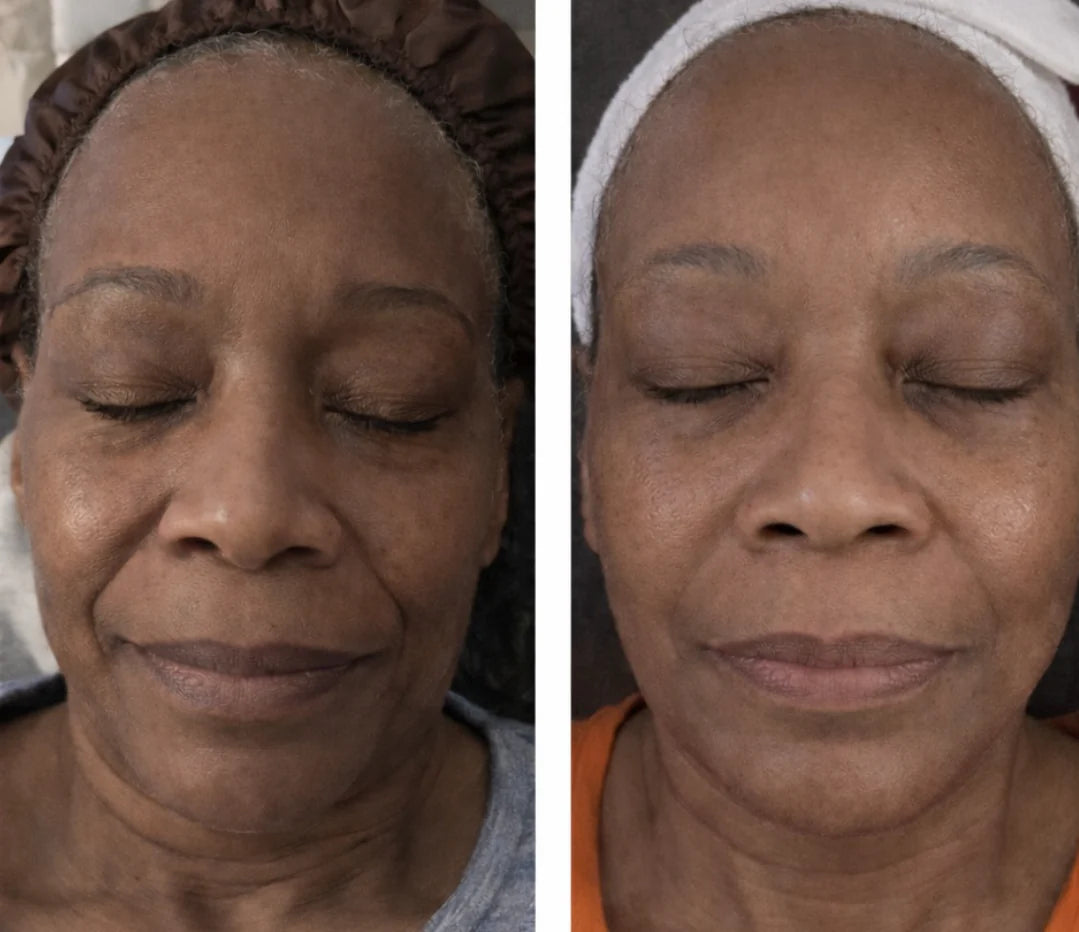NutriveLab™ Ampoule Lift Collagène & Peptides